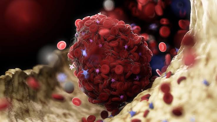 BREAKING DISCOVERY! WHAT COVID INJECTIONS DO TO YOUR BLOOD! DOCTOR RELEASES HORRIFIC FINDINGS!.. - Fringe News