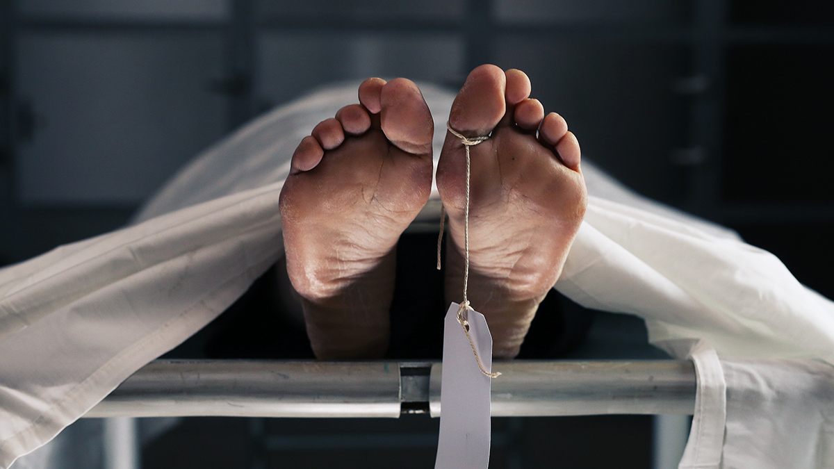 RICHARD HIRSCHMAN - WARNING: EXTREMELY GRAPHIC! STRUCTURES KILLING INJECTED 1 YEAR AFTER SHOT - Fringe News