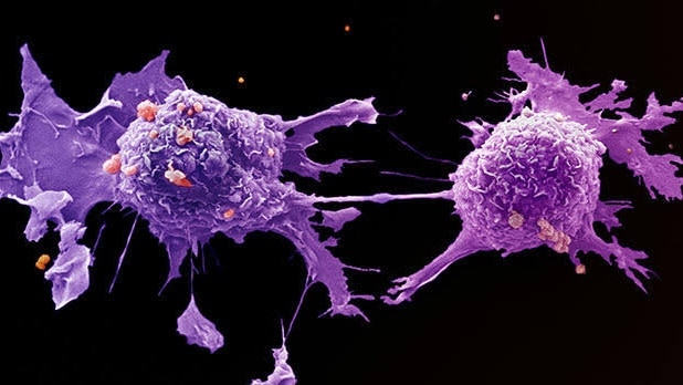 "These Aren't Normal Cancers" - Doctors All Over the World Are Noticing That "Something Is Wrong" - Fringe News